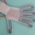3D Printing Used to Develop Hand Exoskeleton for Stroke Patients
