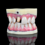 The Stratasys J720 Dental offers fullcolor printing in 500,000 color combinations using multiple materials simultanesouly.
