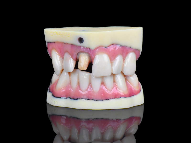 full-color dental