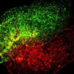 Human Immune cells in a synthetic lymph node produced by Prellis Biologics