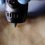 3D Printing Pen Deploys Wound-Healing Ink