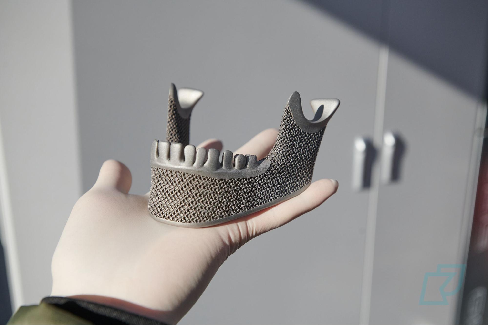 3D printed Jawbone 