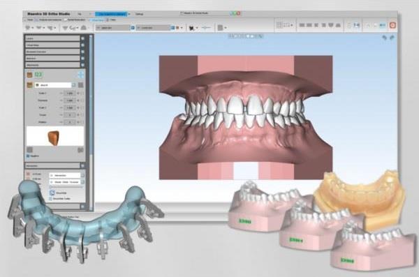 SHINING 3D Collaborates With AGE For Accelerating Dental Solution