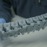 Mighty Oak Medical Forms Partnership for Printing Spinal Models