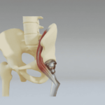 TU Delft 3D Printing Method Mimics Bone-Tendon Connections