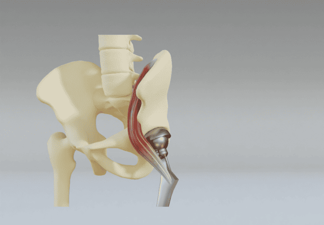 TU Delft 3D Printing Method Mimics Bone-Tendon Connections